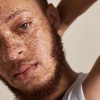 Close Up Of Man With Freckles Dull Skin