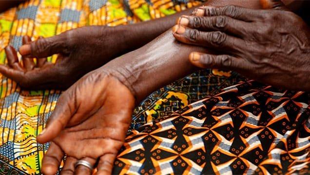 applying shea butter